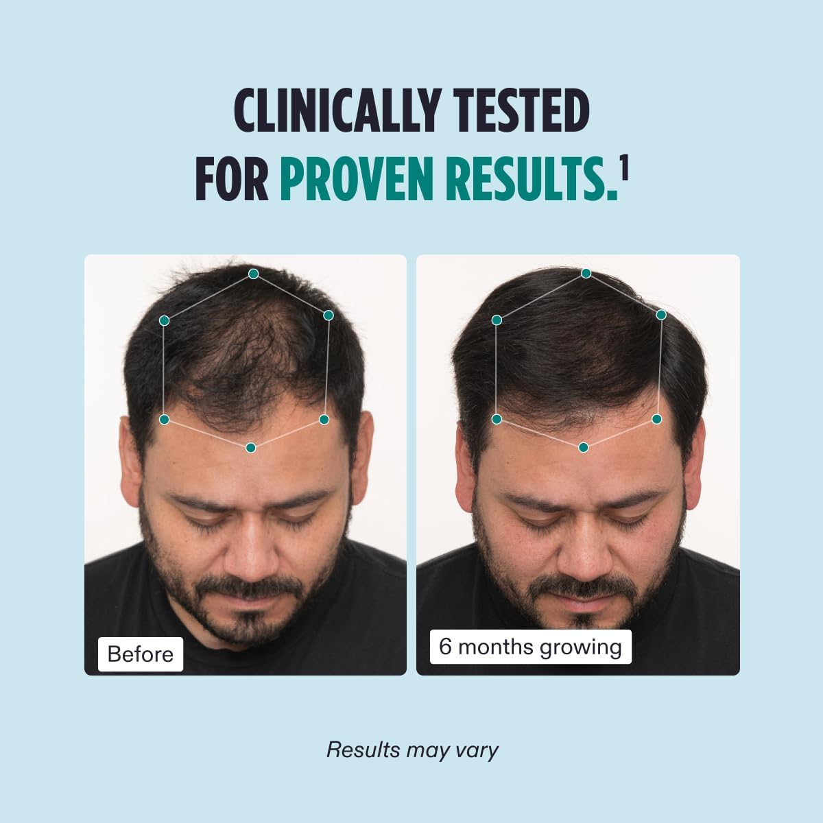 Nutrafol Men Hair Growth – 120 caps (1-month supply). Supports thicker, stronger hair with 4 capsules daily. Clinically proven formula