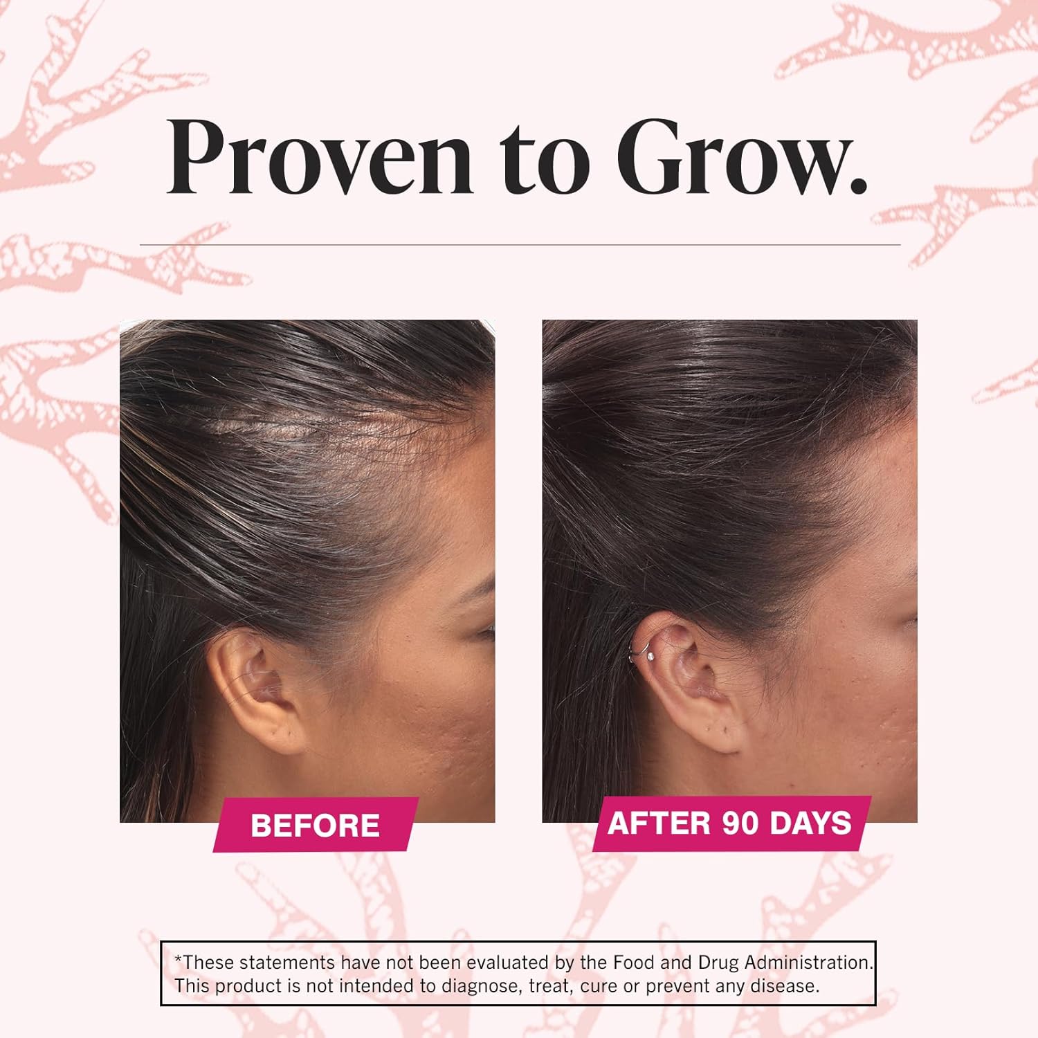 Viviscal Hair Growth for Women – 180 tablets, 3-month supply. Clinically proven with collagen complex for thicker, fuller hair & hair loss nourishment